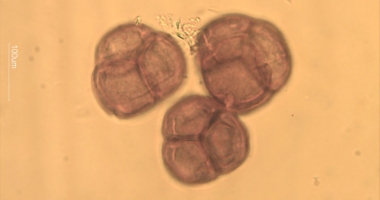 LABORATORIOS APINEVADA SUCURSAL EN PORTUGAL