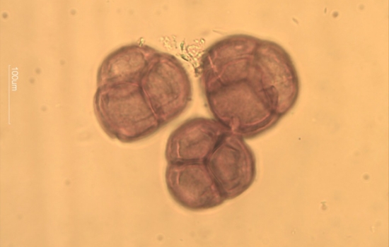 LABORATORIOS APINEVADA SUCURSAL EN PORTUGAL